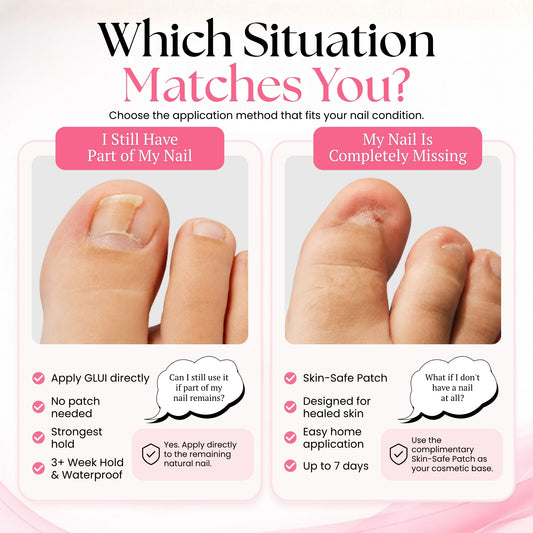 GLUI For Missing & Damaged Toenails - Secret Teddy
