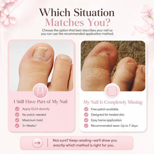 GLUI For Missing & Damaged Toenails