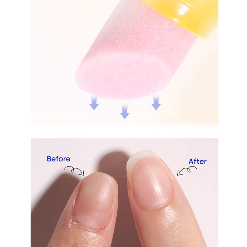 Nail Renewal & Strengthening Pen