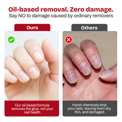 Nail Glue Remover –  Oil Based - Secret Teddy