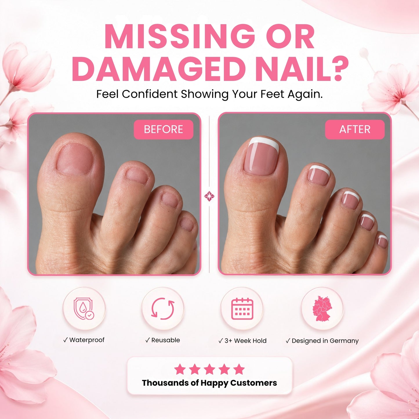 GLUI For Missing & Damaged Toenails - Secret Teddy
