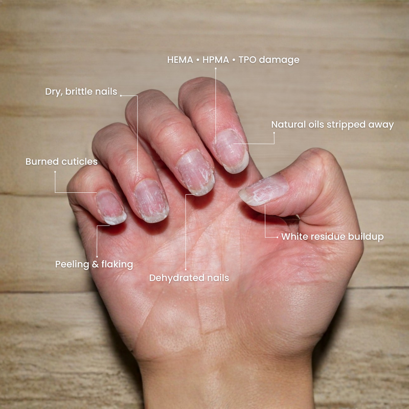 Hand with damaged nails labeled on a wooden background